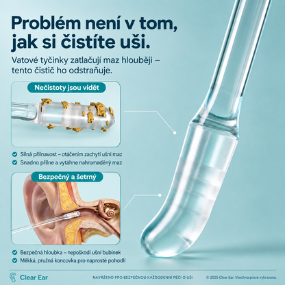 👂𝐋𝐨𝐭𝐦𝐚𝐲® Odstraňovač ušního mazu