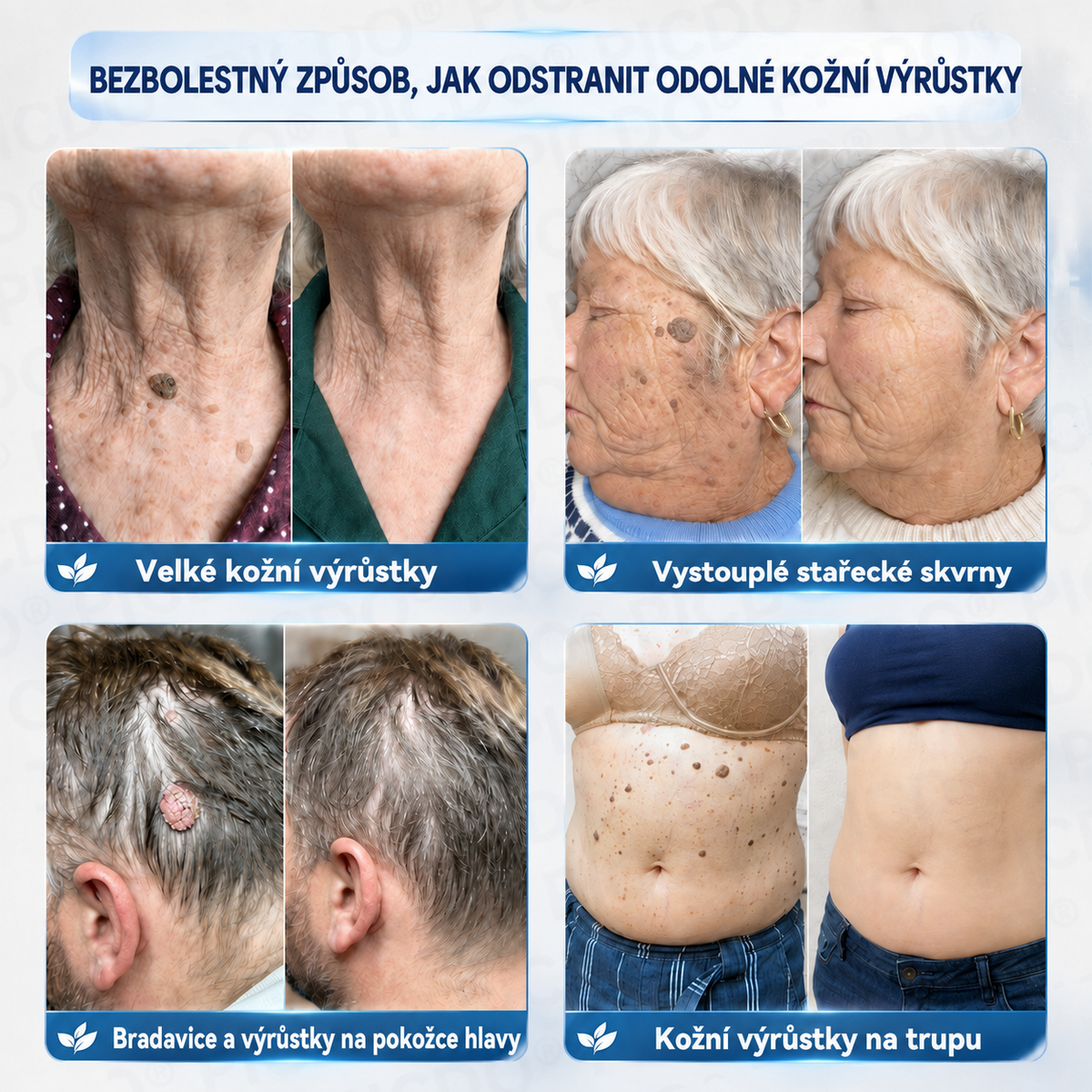 🏥👩‍⚕️𝐏𝐢𝐜𝐝𝐨® 𝟕𝐝𝐞𝐧𝐧í 𝐊𝐫é𝐦 𝐍𝐚 𝐎𝐝𝐬𝐭𝐫𝐚𝐧ě𝐧í 𝐊𝐨ž𝐧í𝐜𝐡 𝐕ý𝐫ů𝐬𝐭𝐤ů 𝐀 𝐒𝐤𝐯𝐫𝐧 🩵 (Bezbolestné složení, které nezanechává jizvy) 💪