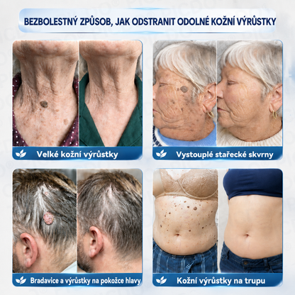 🏥👩‍⚕️𝐏𝐢𝐜𝐝𝐨® 𝟕𝐝𝐞𝐧𝐧í 𝐊𝐫é𝐦 𝐍𝐚 𝐎𝐝𝐬𝐭𝐫𝐚𝐧ě𝐧í 𝐊𝐨ž𝐧í𝐜𝐡 𝐕ý𝐫ů𝐬𝐭𝐤ů 𝐀 𝐒𝐤𝐯𝐫𝐧 🩵 (Bezbolestné složení, které nezanechává jizvy) 💪