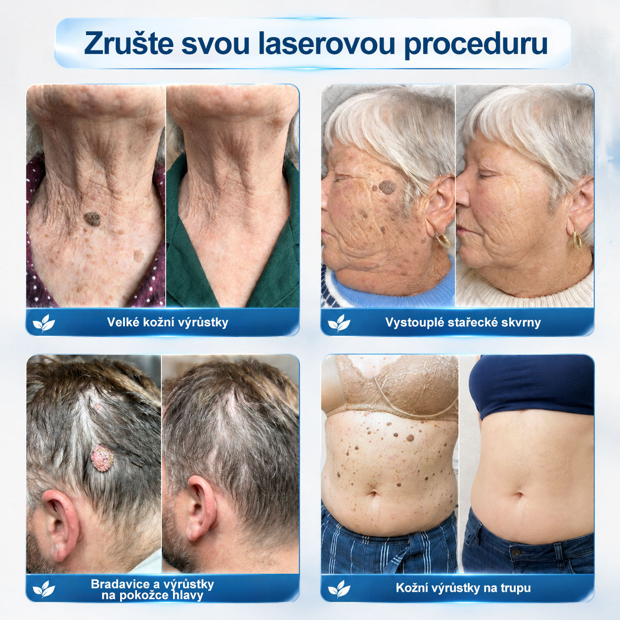 🎁Oficiální značkový obchod |🧬🧬𝐏𝐢𝐜𝑑𝑜® 𝟩𝖽𝖾𝗻𝗻í 𝘰𝘥𝘴𝘵𝗋𝖺ň𝗈𝗏𝖺č 𝒔𝒌𝒗𝒓𝙣 𝙖 𝙥𝙞𝙜𝙢𝙚𝙣𝙩𝘰𝘷ý𝘤𝘩 𝘴𝘬𝖛𝖗𝖓 (Bezbolestný rollerball bez jizev)🧡