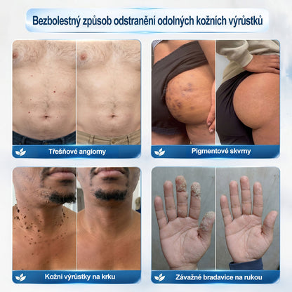 🎁Oficiální značkový obchod |✨✨𝐏𝐢𝐜𝑑𝑜® 𝟩𝖽𝖾𝗻𝗻í 𝘰𝘥𝘴𝘵𝗋𝖺ň𝗈𝗏𝖺č 𝒔𝒌𝒗𝒓𝙣 𝙖 𝙥𝙞𝙜𝙢𝙚𝙣𝙩𝘰𝘷ý𝘤𝘩 𝘴𝘬𝖛𝖗𝖓 (Bezbolestný rollerball bez jizev)🧡