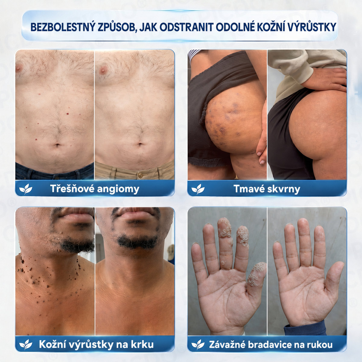 🏥👩‍⚕️𝐏𝐢𝐜𝐝𝐨® 𝟕𝐝𝐞𝐧𝐧í 𝐊𝐫é𝐦 𝐍𝐚 𝐎𝐝𝐬𝐭𝐫𝐚𝐧ě𝐧í 𝐊𝐨ž𝐧í𝐜𝐡 𝐕ý𝐫ů𝐬𝐭𝐤ů 𝐀 𝐒𝐤𝐯𝐫𝐧 🩵 (Bezbolestné složení, které nezanechává jizvy) 💪