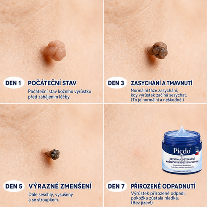 🏥👩‍⚕️𝐏𝐢𝐜𝐝𝐨® 𝟕𝐝𝐞𝐧𝐧í 𝐊𝐫é𝐦 𝐍𝐚 𝐎𝐝𝐬𝐭𝐫𝐚𝐧ě𝐧í 𝐊𝐨ž𝐧í𝐜𝐡 𝐕ý𝐫ů𝐬𝐭𝐤ů 𝐀 𝐒𝐤𝐯𝐫𝐧 🩵 (Bezbolestné složení, které nezanechává jizvy) 💪