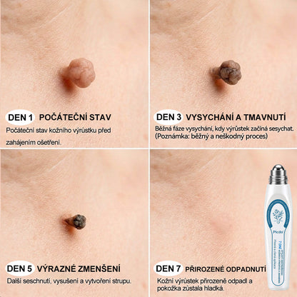 🎁Oficiální značkový obchod |✨✨𝐏𝐢𝐜𝑑𝑜® 𝟩𝖽𝖾𝗻𝗻í 𝘰𝘥𝘴𝘵𝗋𝖺ň𝗈𝗏𝖺č 𝒔𝒌𝒗𝒓𝙣 𝙖 𝙥𝙞𝙜𝙢𝙚𝙣𝙩𝘰𝘷ý𝘤𝘩 𝘴𝘬𝖛𝖗𝖓 (Bezbolestný rollerball bez jizev)🧡