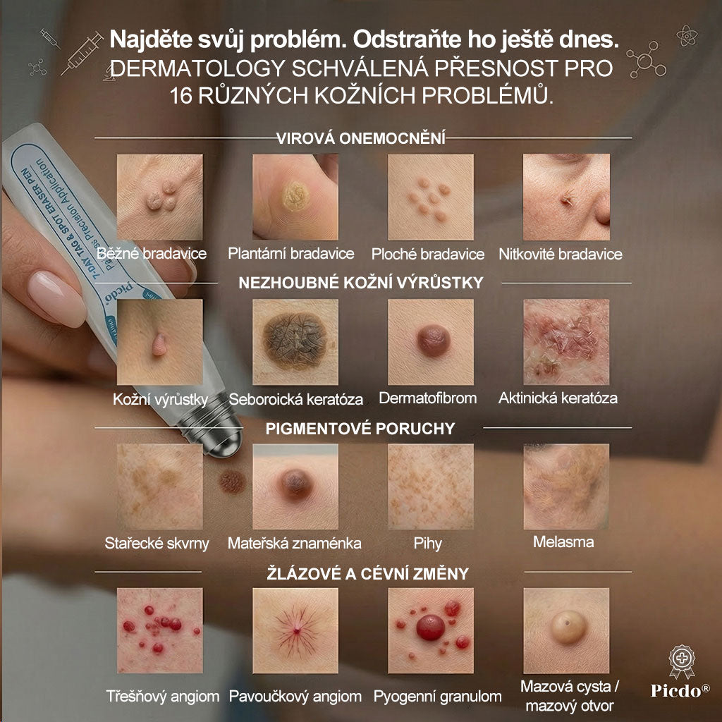 🎁Oficiální značkový obchod |🌟🌟𝐏𝐢𝐜𝑑𝑜® 𝟩𝖽𝖾𝗻𝗻í 𝘰𝘥𝘴𝘵𝗋𝖺ň𝗈𝗏𝖺č 𝒔𝒌𝒗𝒓𝙣 𝙖 𝙥𝙞𝙜𝙢𝙚𝙣𝙩𝘰𝘷ý𝘤𝘩 𝘴𝘬𝖛𝖗𝖓 (Bezbolestný rollerball bez jizev)🧡